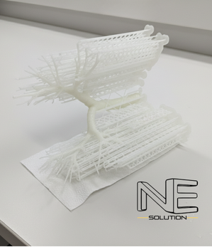 A 3D printed trachea model fresh off the printer, showing the complex lattice support structures required for the SLA printing process.